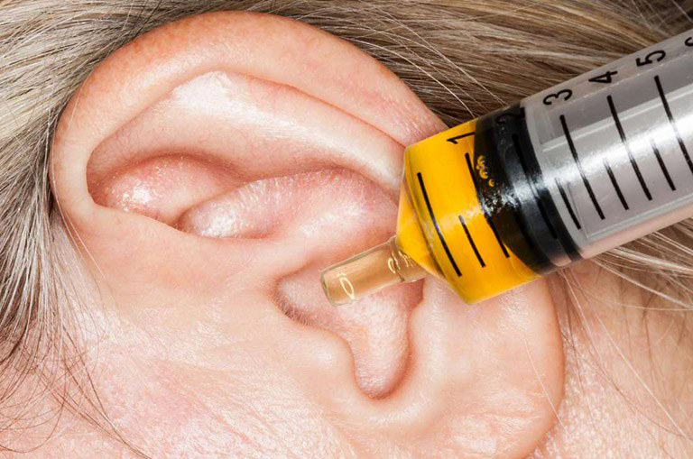 Có thể rửa tai với nước sạch hoặc nước muối sinh lý bằng ống tiêm