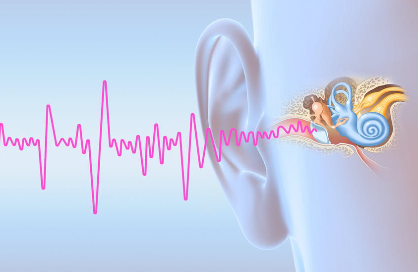 Ráy tai nhiều làm ngăn chặn sóng âm, gây ù tai