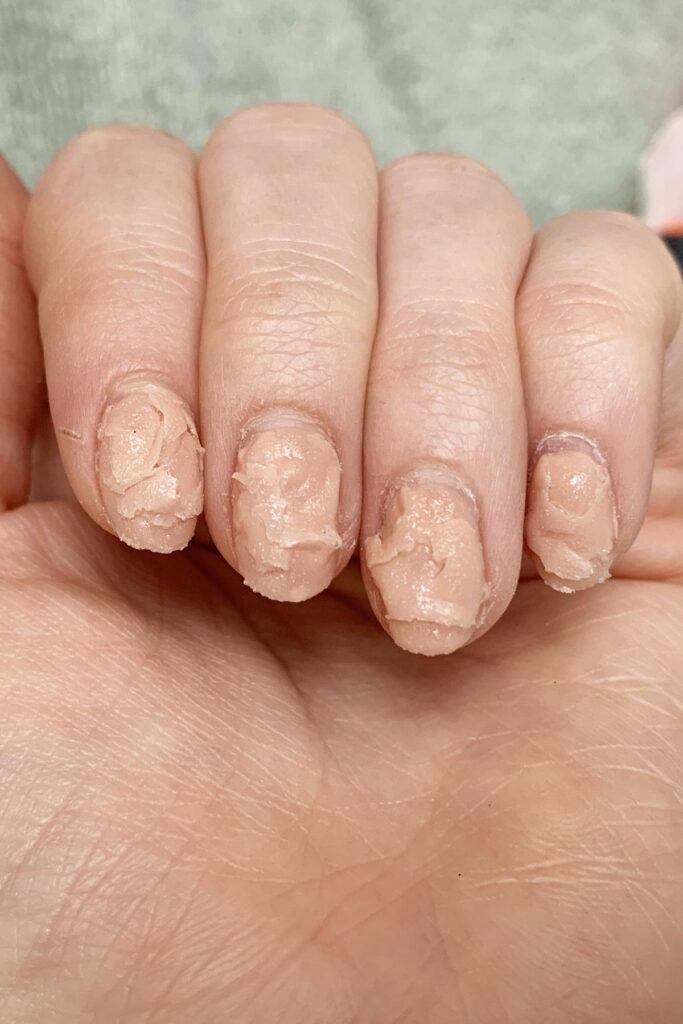 Vì Sao Acetone Được Xem Là Cách Phá Gel Không Hại Móng?