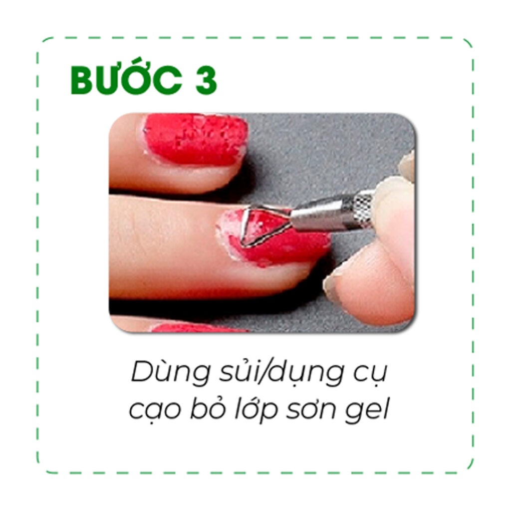Bước 3 - Gỡ Giấy Bạc Và Đẩy Nhẹ Gel Bong Ra