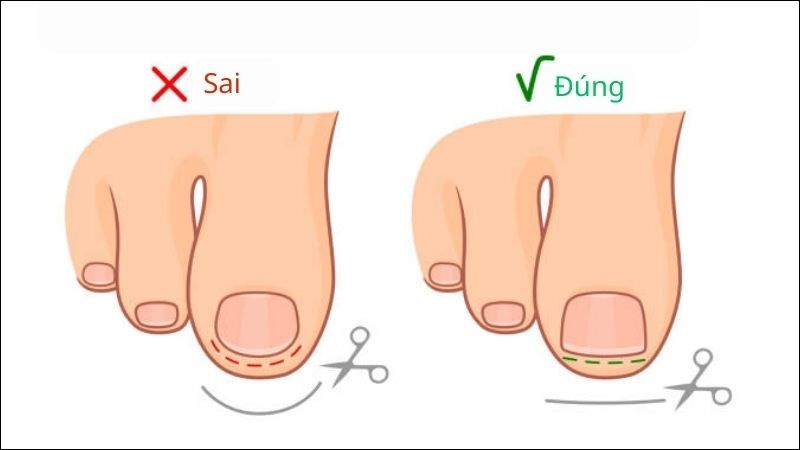 Có Nên Tự Xử Lý Tại Nhà Hay Cần Đến Bác Sĩ?